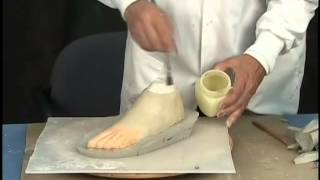 Custom Fabrication of A Silicone Partial Foot Prosthesis [upl. by Sonnie745]