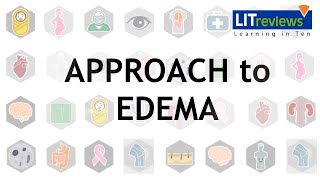 Approach To Edema [upl. by Chasse]