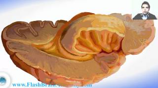 Brain Ventricles Anatomy And Insular Cortex [upl. by Pardew98]