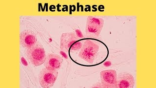 What happens during metaphase [upl. by Lledal]