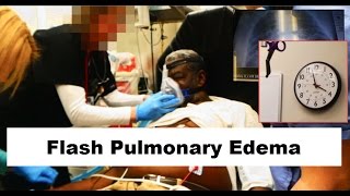 Flash Pulmonary Edema Emergency [upl. by Auhsej]