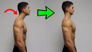 FIX Forward Head Posture Daily Corrective Routine [upl. by Modnar]