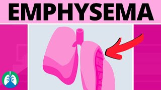 Emphysema Medical Definition  Quick Explainer Video [upl. by Arathorn]