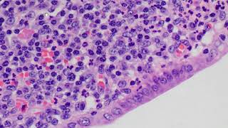 Leukocytes in histology [upl. by Sallyanne616]