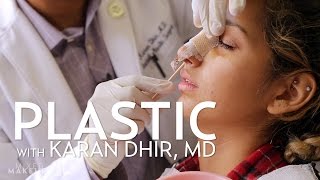 Savannahs Rhinoplasty Surgery Experience  PLASTIC with Dr Dhir [upl. by Wivina337]