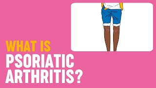 Psoriatic Arthritis vs Rheumatoid Arthritis [upl. by Annairda]