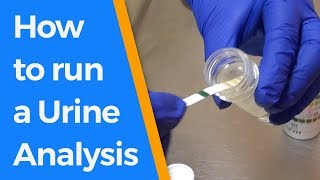 How to run a Urine Analysis [upl. by Ellora]