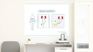 Bladder Cancer Treatment Urinary Diversion  Urology Care Foundation [upl. by Pallua]