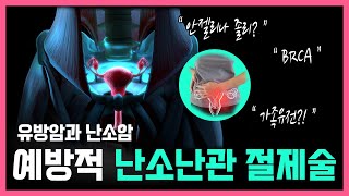 유방암과 난소암 예방적 난소난관 절제술 필요할까 [upl. by Savadove]