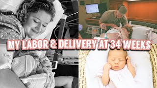 MY BIRTH STORY  34 WEEK DELIVERY [upl. by Finegan]